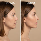 Viso Lift
